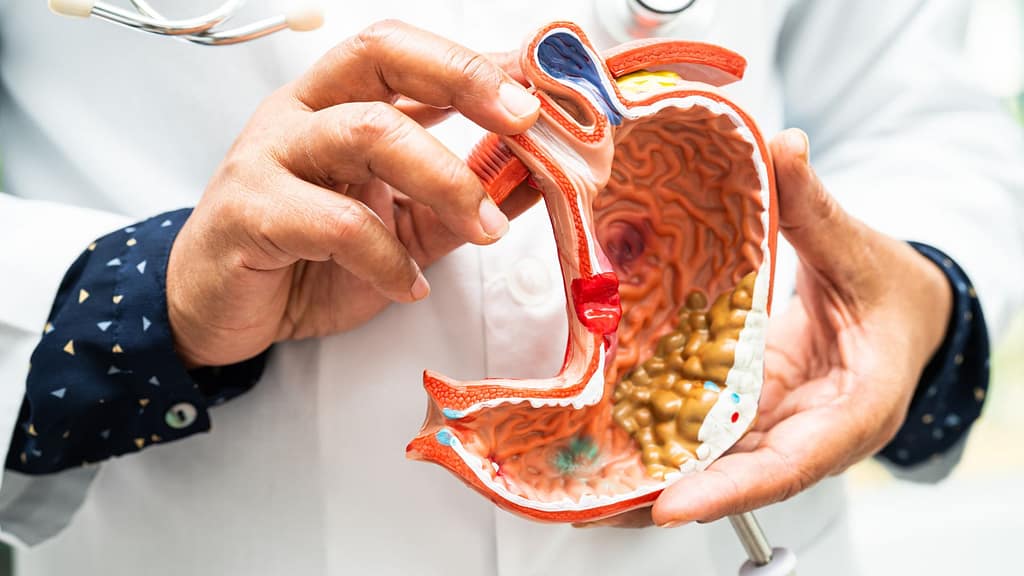 Improves Digestive Health