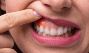 10 Essential Tips for Maintaining Healthy Teeth and Gums